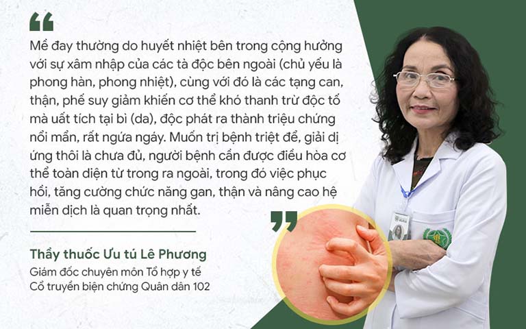Bác sĩ Lê Phương chia sẻ về phương pháp điều trị mề đay 