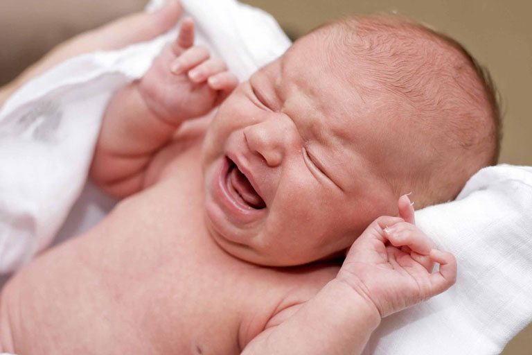 Khi bị chàm sữa trẻ thường xuyên quấy khóc và ít ngủ hơn so với bình thường